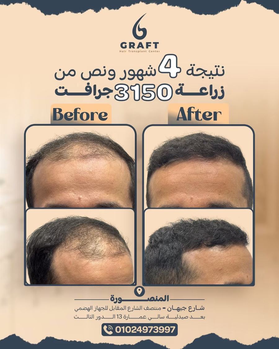 3150 جرافت