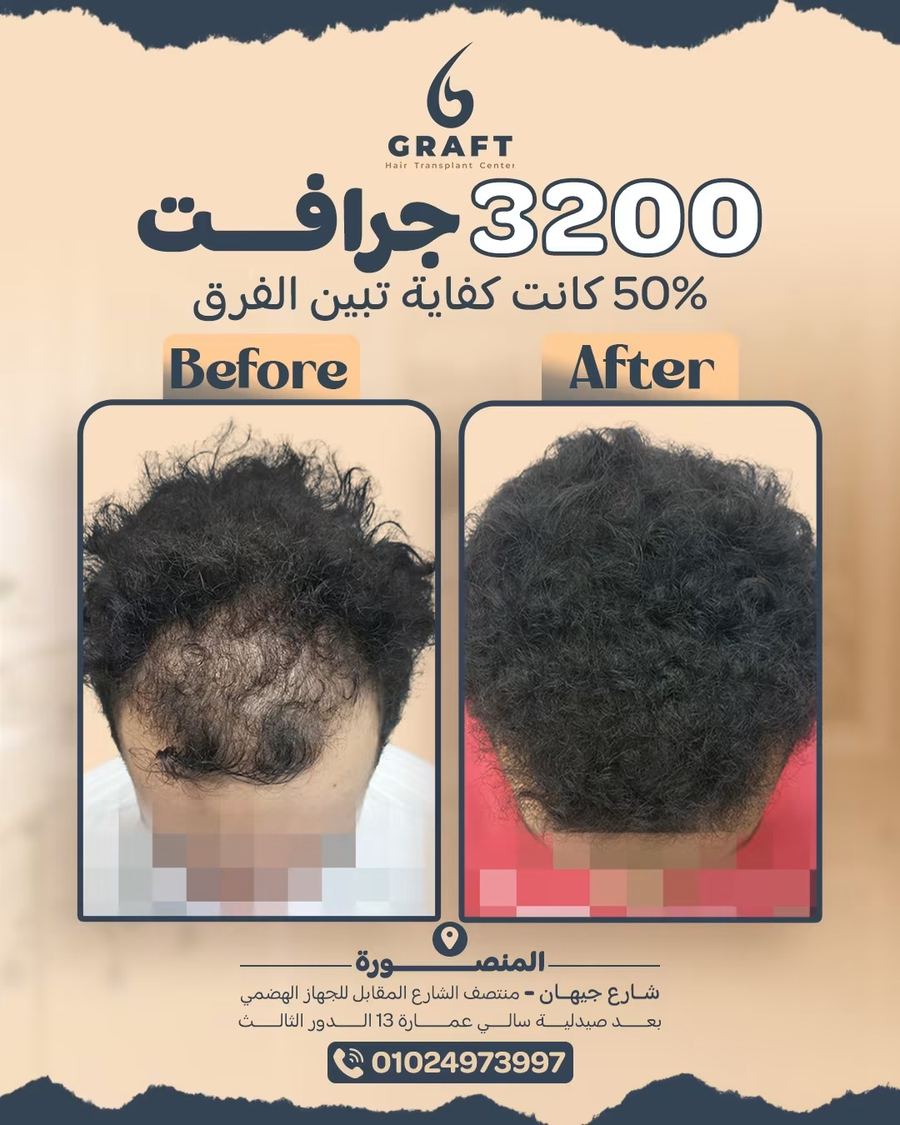 3200 جرافت