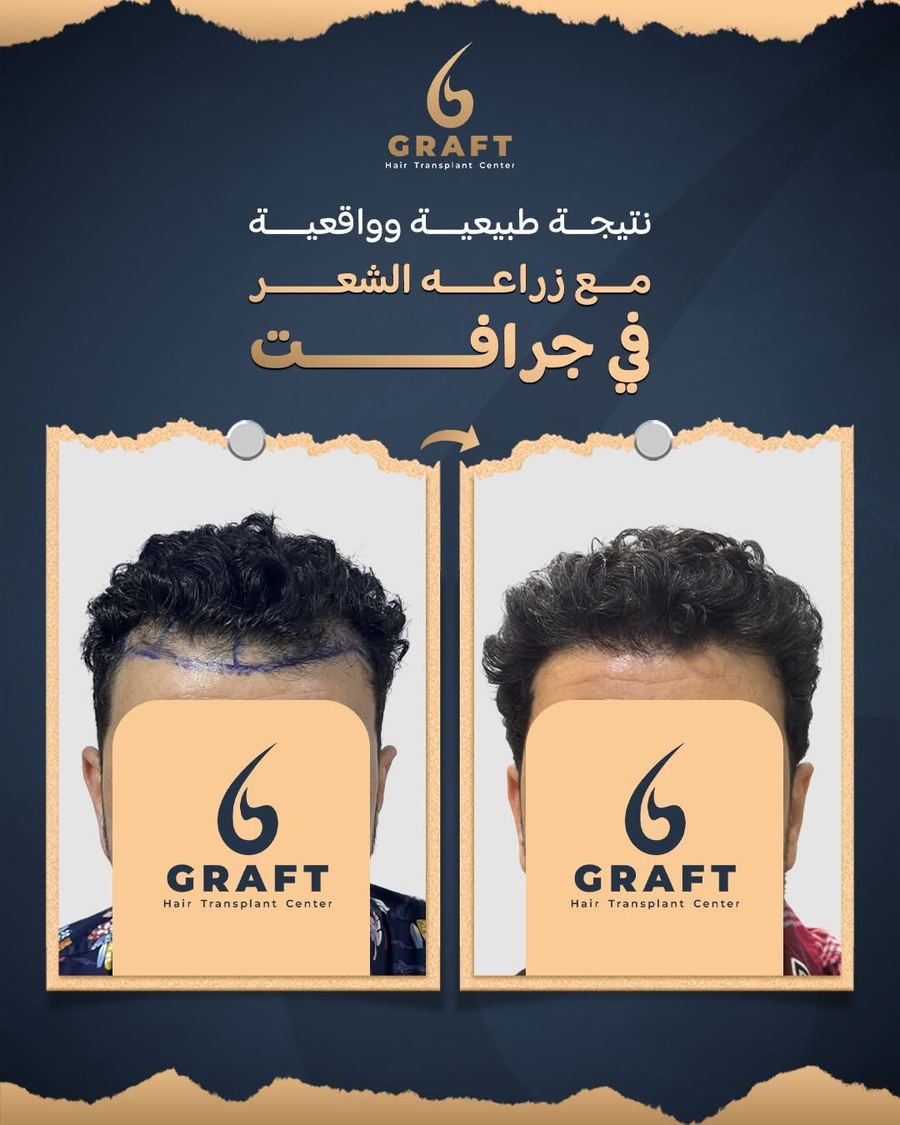 نتيجة طبيعية وواقعية
