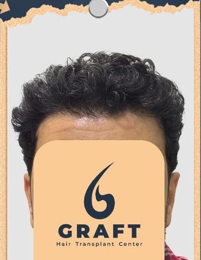 نتيجة طبيعية وواقعية